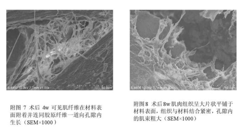 「钽涂层专栏第三期」钽金属的生物学特性和理化性质