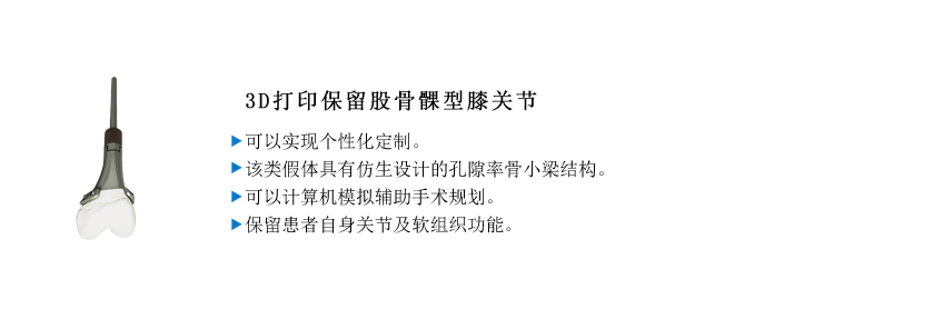 3D打印膝关节.jpg